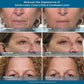 🔥Rapid Reduction Eye Serum - 5-Minute Tightening, Anti-Aging Miracle for Eyes & Face! ✨