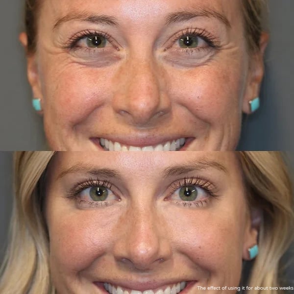 🔥Buy 1 Get 1 Free✨Luminous Eye Corrector SPF 41