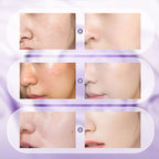 ✨2025 Antioxidant Brightening Black Technology|Niacinamide Luminous Serum × Buy and get a free full-size size 💎