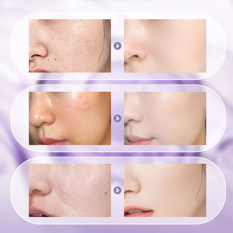 ✨2025 Antioxidant Brightening Black Technology|Niacinamide Luminous Serum × Buy and get a free full-size size 💎