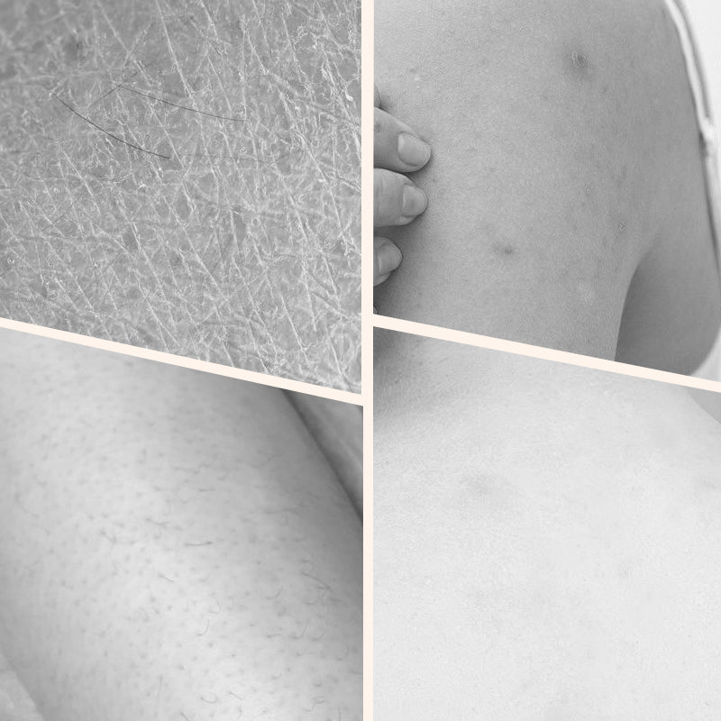 Brightening & Moisturizing Body Bare Skin Cream