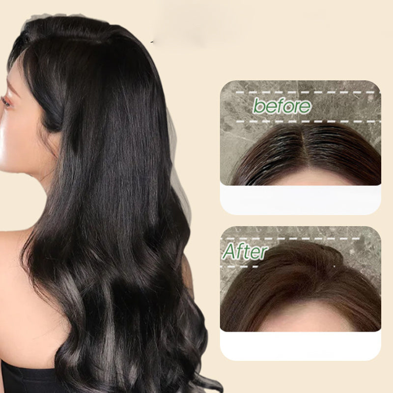 No-rinse Fluffy Oil Control Shampoo（50% OFF）