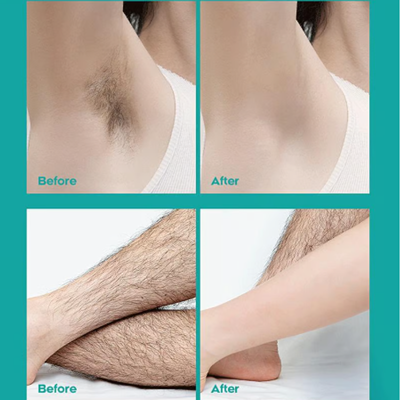 🔥 Unisex painless hair removal cream! Gentle on the skin ⏳ limited time offer