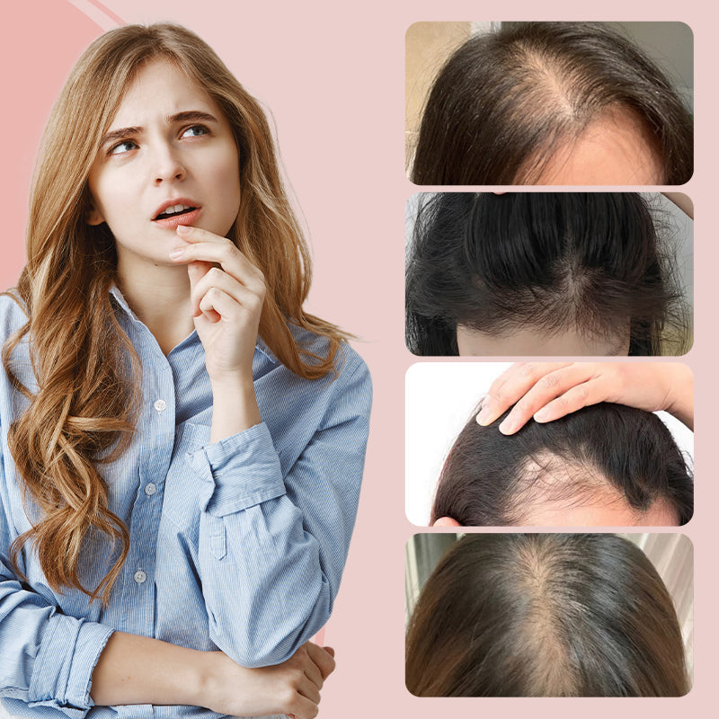 Multi-purpose hairline powder 🌟 Buy 1 Get 1 + Free Shipping｜Natural coloring, long-lasting baldness filling