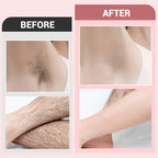 🎉2025 Hot Sale🎉Gentle & Effective Hair Removal Cream