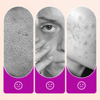 🔥 Buy 2 get 1 free Flawless Under Eye Concealer｜Brighten Dark Circles, Crease